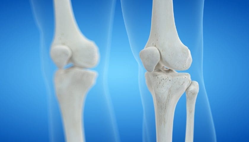 Thumbnail for HEALTH TRENDS: Dairy & Bone Health